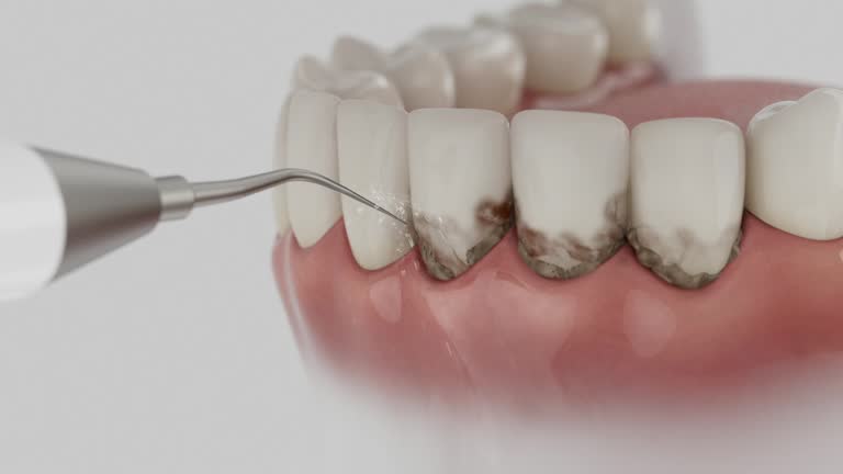 Reliable Dental Implants contractor in Bridgeton, MO by Smile Center Dentistry